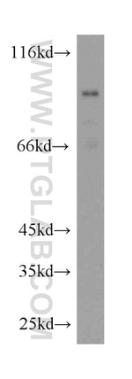 CPT1A Antibody in Western Blot (WB)