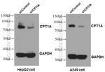 CPT1A Antibody in Western Blot (WB)
