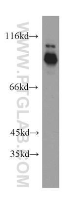 CPT1A Antibody in Western Blot (WB)