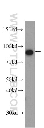CPT1A Antibody in Western Blot (WB)