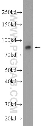 CPT1A Antibody in Western Blot (WB)