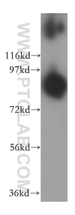 CPT1A Antibody in Western Blot (WB)