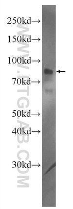 CPT1A Antibody in Western Blot (WB)