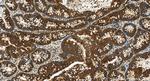 RPL36A Antibody in Immunohistochemistry (Paraffin) (IHC (P))