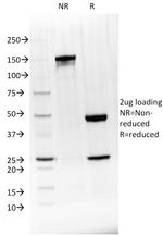 BTLA Monoclonal Antibody (BTLA/1528)