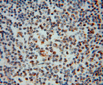 MRPL37 Antibody in Immunohistochemistry (Paraffin) (IHC (P))