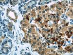 COL4A3BP Antibody in Immunohistochemistry (Paraffin) (IHC (P))