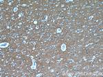 ATP1B1 Antibody in Immunohistochemistry (Paraffin) (IHC (P))