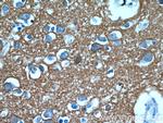 ATP1B1 Antibody in Immunohistochemistry (Paraffin) (IHC (P))