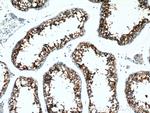 CD98 Antibody in Immunohistochemistry (Paraffin) (IHC (P))