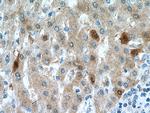 DHFR Antibody in Immunohistochemistry (Paraffin) (IHC (P))