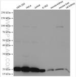 DHFR Antibody in Western Blot (WB)