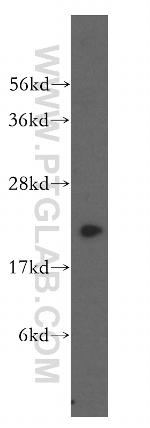 DHFR Antibody in Western Blot (WB)