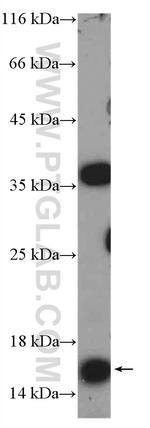 MED10 Antibody in Western Blot (WB)