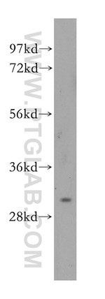 CA3 Antibody in Western Blot (WB)