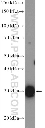 CA3 Antibody in Western Blot (WB)