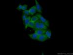CA3 Antibody in Immunocytochemistry (ICC/IF)