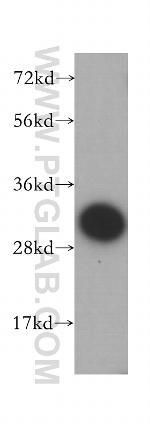 CA3 Antibody in Western Blot (WB)