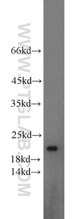 TMP21 Antibody in Western Blot (WB)