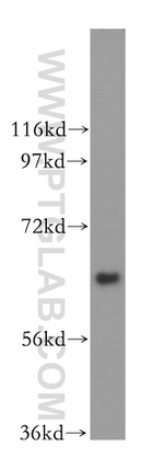 TFCP2 Antibody in Western Blot (WB)