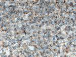 CRACR2A Antibody in Immunohistochemistry (Paraffin) (IHC (P))