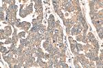 DDX19A Antibody in Immunohistochemistry (Paraffin) (IHC (P))