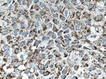 OGDH Antibody in Immunohistochemistry (Paraffin) (IHC (P))