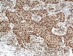 RPB5 Antibody in Immunohistochemistry (Paraffin) (IHC (P))
