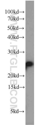 RPB5 Antibody in Western Blot (WB)