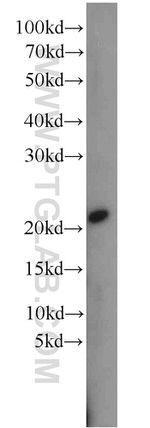 RPB5 Antibody in Western Blot (WB)