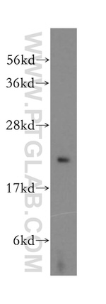 RPB5 Antibody in Western Blot (WB)