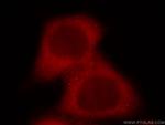 STIP1 Antibody in Immunocytochemistry (ICC/IF)