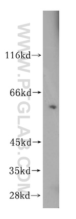 STIP1 Antibody in Western Blot (WB)