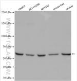 NT5C2 Antibody in Western Blot (WB)