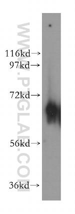 NT5C2 Antibody in Western Blot (WB)