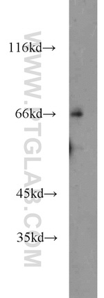 NT5C2 Antibody in Western Blot (WB)