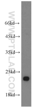 RPL21 Antibody in Western Blot (WB)