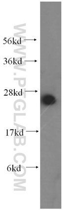 RPL21 Antibody in Western Blot (WB)