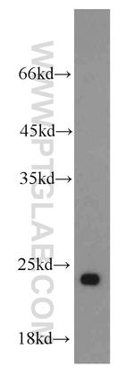 RPL21 Antibody in Western Blot (WB)