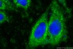 LOXL2 Antibody in Immunocytochemistry (ICC/IF)