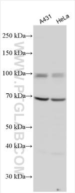 LOXL2 Antibody in Western Blot (WB)