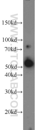 ACP2 Antibody in Western Blot (WB)