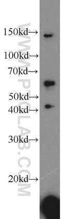 ACP2 Antibody in Western Blot (WB)