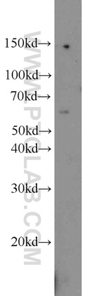 ACP2 Antibody in Western Blot (WB)