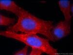 HLA class I ABC Antibody in Immunocytochemistry (ICC/IF)