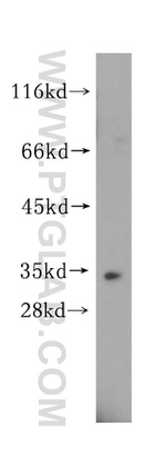 ESD Antibody in Western Blot (WB)