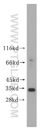 ESD Antibody in Western Blot (WB)