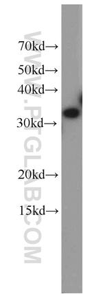 ESD Antibody in Western Blot (WB)