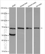 OSGIN1 Antibody in Western Blot (WB)