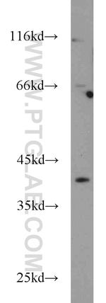 OSGIN1 Antibody in Western Blot (WB)